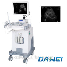 sonography ultrasound scanner ultrasonic machine
